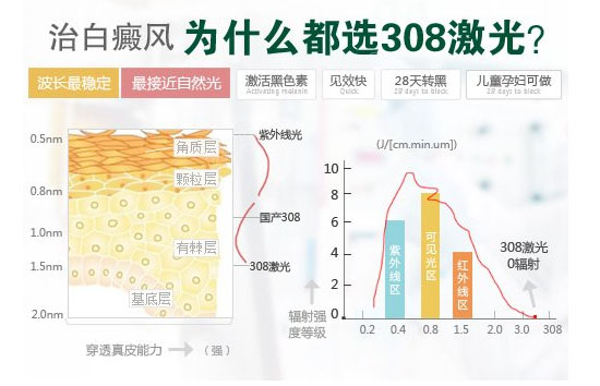 白癜风激光治疗怎么样