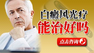 白癜风308激光和蓝痒的哪个好