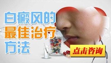 突发性白癜风要怎么治疗