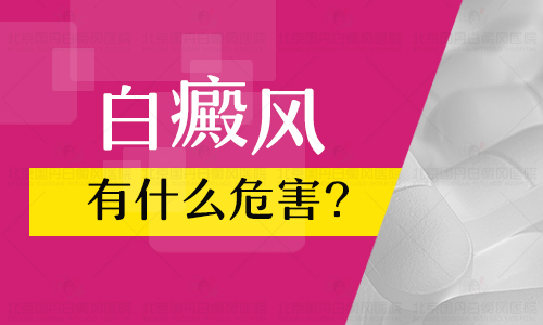 局限性白癜风会不会扩散到别处